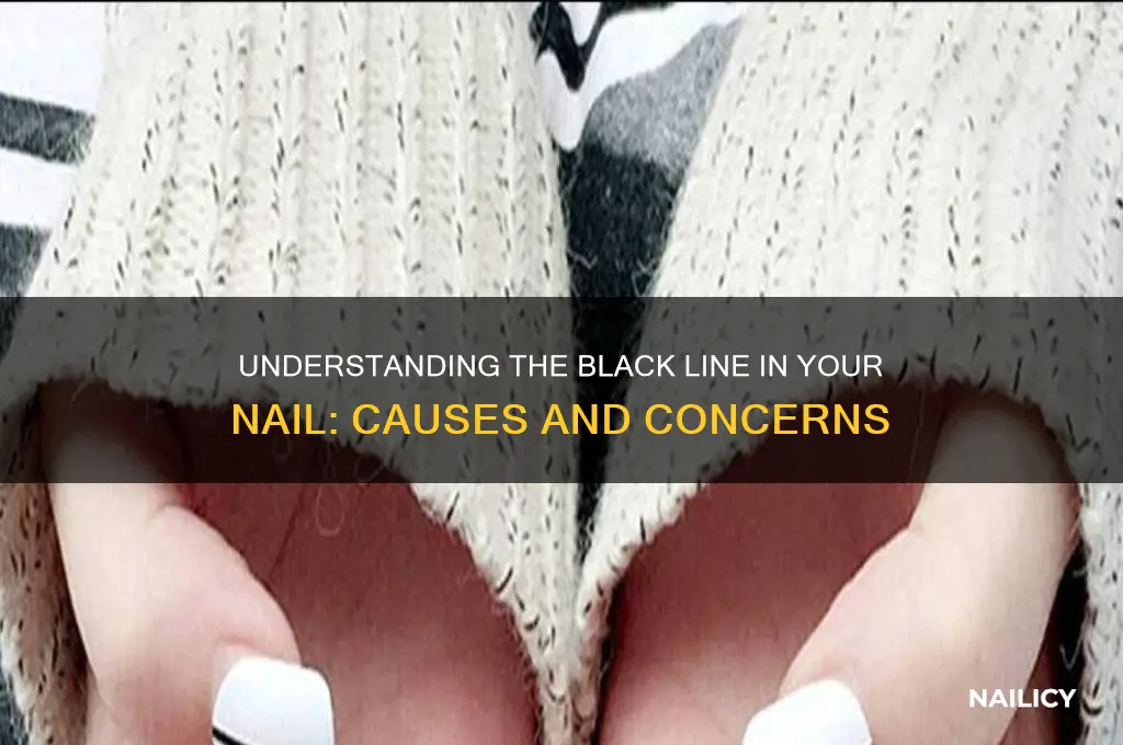 what is a black line in your nail