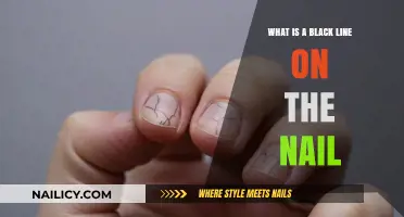 Understanding the Black Line on Your Nail: Causes and Concerns