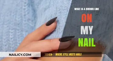 Brown Line on Nail: Causes, Concerns, and When to Seek Help