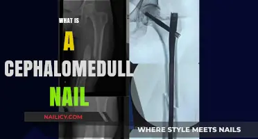 Understanding Cephalomedullary Nails: A Comprehensive Guide