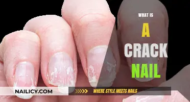 Understanding Crack Nails: Causes, Symptoms, and Effective Treatments