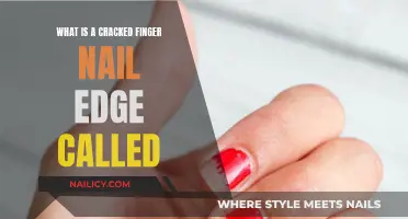 The Mystery of Splintered Fingernails and Their Causes