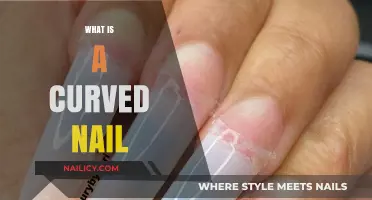 Understanding Curved Nails: Causes, Symptoms, and Effective Treatments