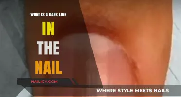 Understanding the Dark Line in Your Nail: Causes and Concerns