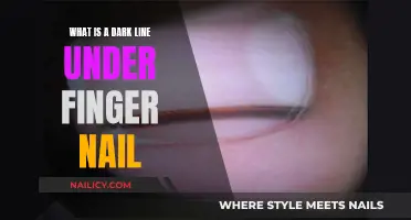 Understanding the Mystery: What Causes a Dark Line Under Your Nail?