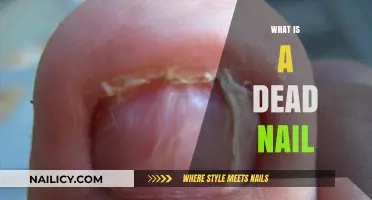 Understanding Dead Nails: Causes, Symptoms, and Effective Treatments