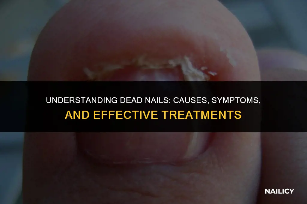 what is a dead nail
