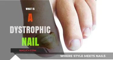 Understanding Dystrophic Nails: Causes, Symptoms, and Treatment Options