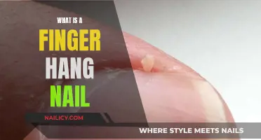 Understanding the Unique Condition: Finger Hang Nail