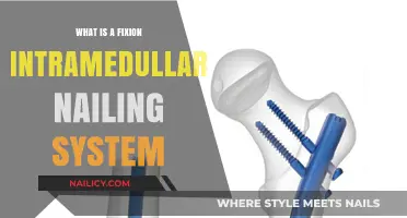 Understanding the Fixion Intramedullary Nailing System: A Comprehensive Guide