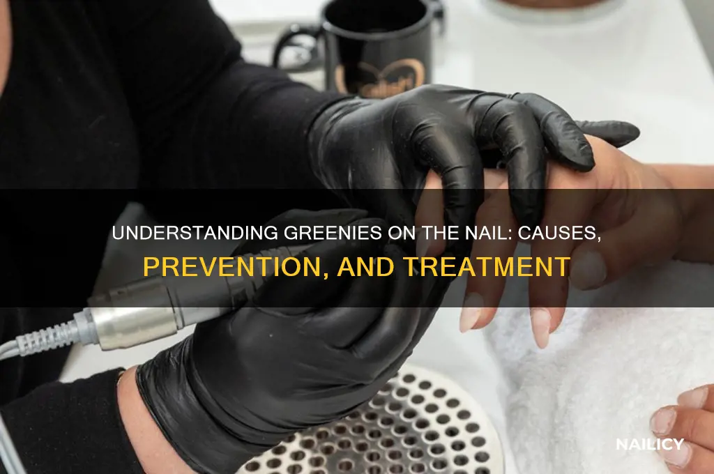 what is a greenie on the nail