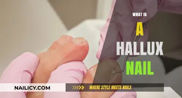 Understanding Hallux Nails: Causes, Symptoms, and Effective Treatments