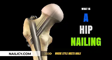 Understanding Hip Nailing: A Comprehensive Guide to the Procedure