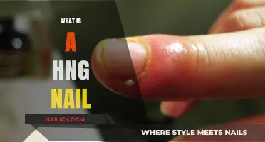 Understanding the Pain: What is a Hangnail and How to Treat It