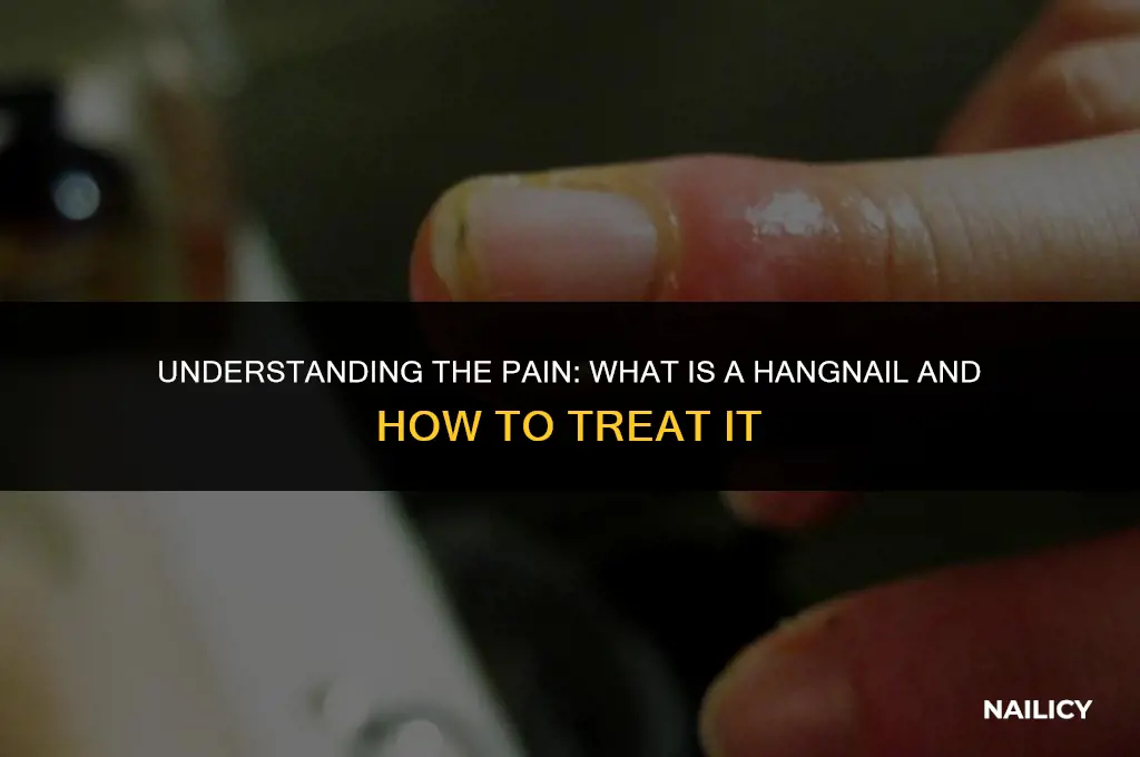 what is a hng nail