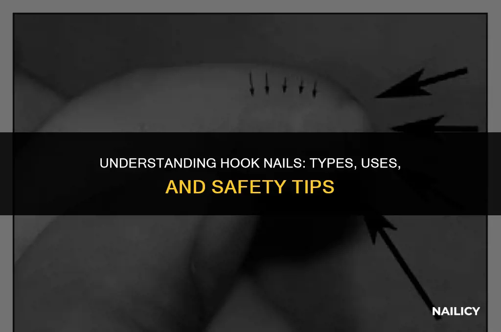 what is a hook nail