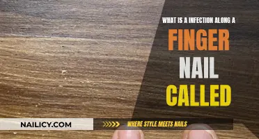 Infections Along Fingernails: What's the Real Danger?
