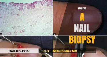 Understanding Nail Biopsies: Procedure, Purpose, and What to Expect