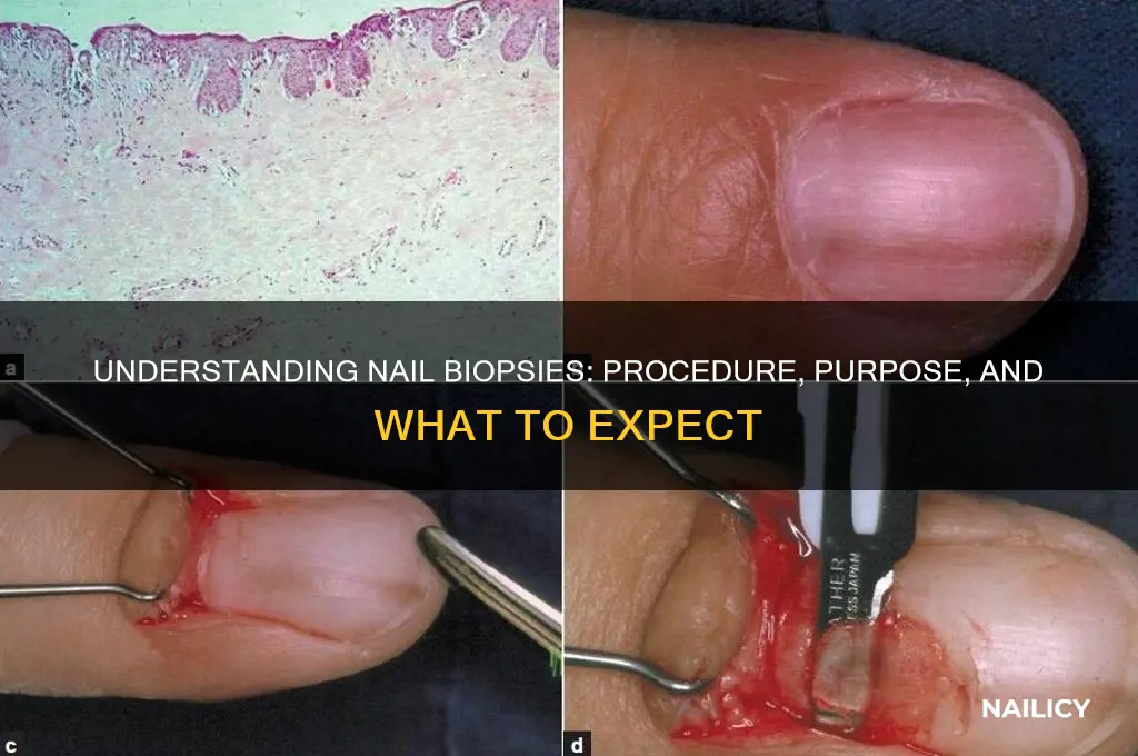 what is a nail biopsy