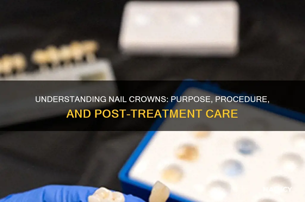 what is a nail crown