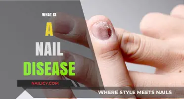 Understanding Nail Diseases: Causes, Symptoms, and Effective Treatment Options