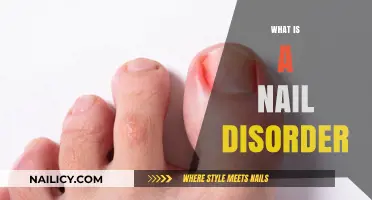 Understanding Nail Disorders: Causes, Symptoms, and Treatment Options Explained