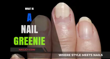 Understanding Nail Greenies: Causes, Prevention, and Treatment Explained
