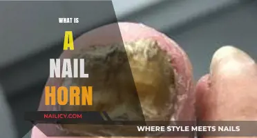 Understanding Nail Horns: Causes, Symptoms, and Effective Treatment Options