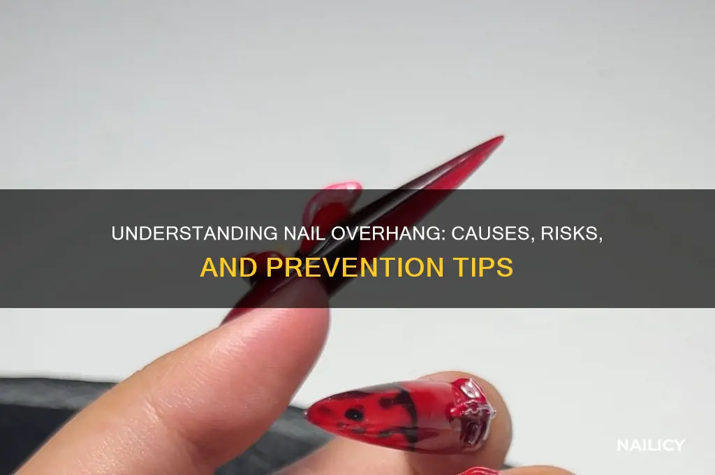 what is a nail overhang