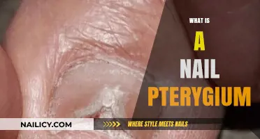 Understanding Nail Pterygium: Causes, Symptoms, and Treatment Options