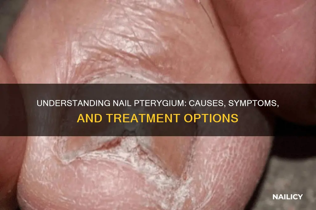 what is a nail pterygium