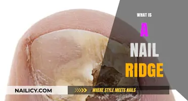 Understanding Nail Ridges: Causes, Concerns, and Care Tips
