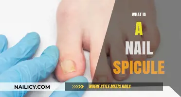 Understanding Nail Spicules: Causes, Symptoms, and Effective Treatment Options