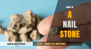 Understanding Nail Stones: Causes, Symptoms, and Effective Treatment Options