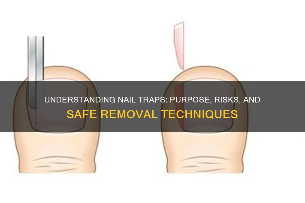 what is a nail trap