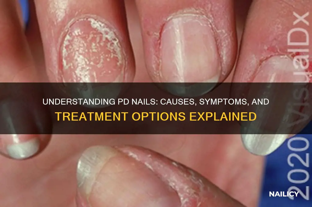what is a pd nail
