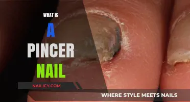 Understanding Pincer Nails: Causes, Symptoms, and Effective Treatment Options