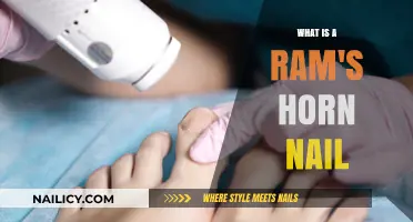 Understanding Ram's Horn Nails: Causes, Symptoms, and Treatment Options