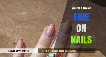 Ring of Fire on Nails: Causes, Symptoms, and Treatment Explained