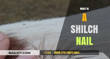 Understanding Shilch Nails: Uses, Benefits, and Application Techniques Explained
