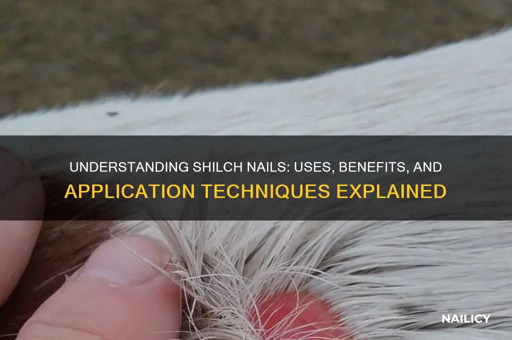 what is a shilch nail