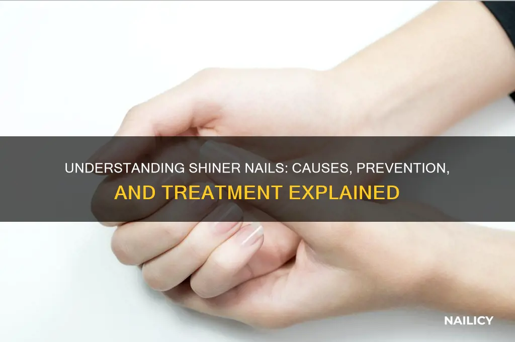 what is a shiner nail