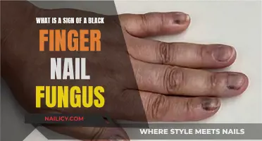 Black Finger: Unveiling the Signs of Fungal Infection