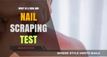 Understanding Skin and Nail Scraping Tests: Purpose, Procedure, and Results