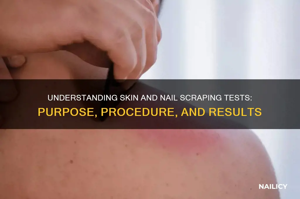 what is a skin and nail scraping test