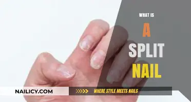Understanding Split Nails: Causes, Prevention, and Effective Treatment Options