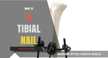 Understanding Tibial Nails: Essential Guide to Intramedullary Fixation