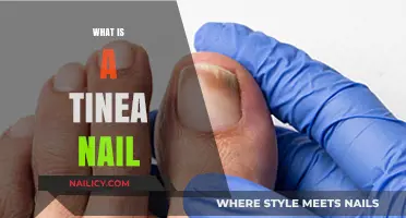 Understanding Tinea Nail: Causes, Symptoms, and Effective Treatment Options