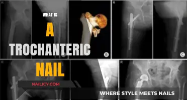 Understanding Trochanteric Nails: Purpose, Procedure, and Recovery Explained