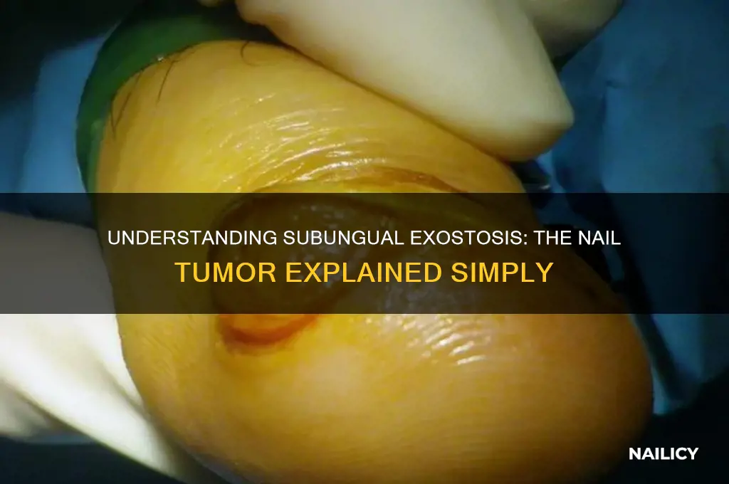 what is a tumor of the nail called